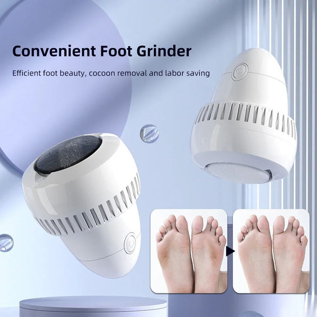 Electric Foot Callus Remover – Rechargeable Pedicure Tool with Vacuum & Replacement Roller”