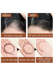 Organic Batana Oil Hair Butter – 100% Pure, Strengthens & Promotes Healthy Hair Growth